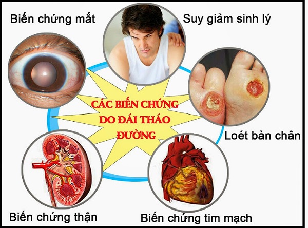 Viên uống Hatidu giúp hạ đường huyết, chống biến chứng tiểu đường lọ 30 viên