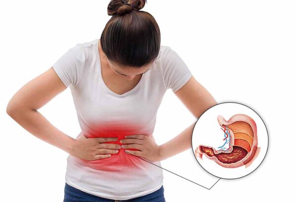 Bệnh nhân đau dạ dày