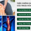 Viên bổ sung dưỡng chất cho khớp Artimobi Lọ 60 viên (Pháp)