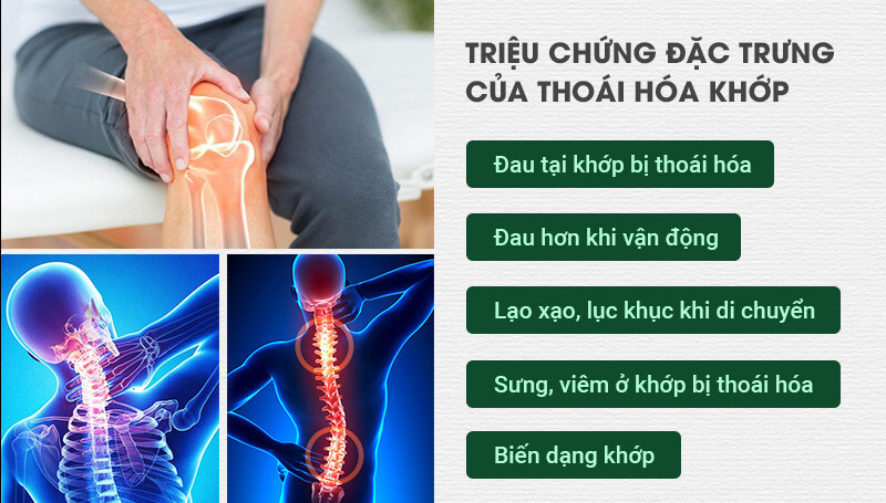 Viên bổ sung dưỡng chất cho khớp Artimobi Lọ 60 viên (Pháp)